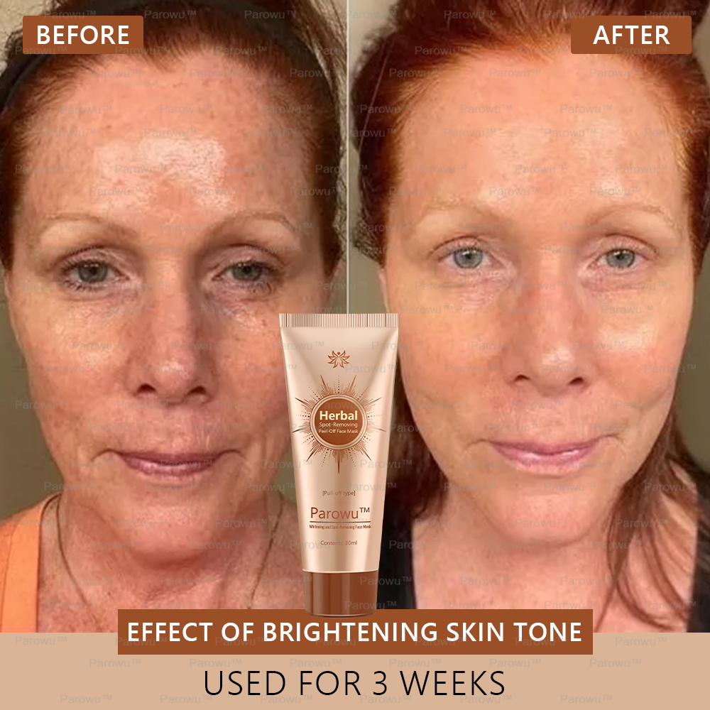 🏵️🏵️ Parowu™ Whitening and Spot-Removing Face Mask Suitable for face and body – 👩⚕️ Natural ingredients permanently remove age spots, freckles, sun spots, and liver spots.